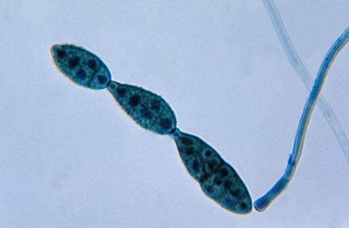 Chain of conidia of Alternaria