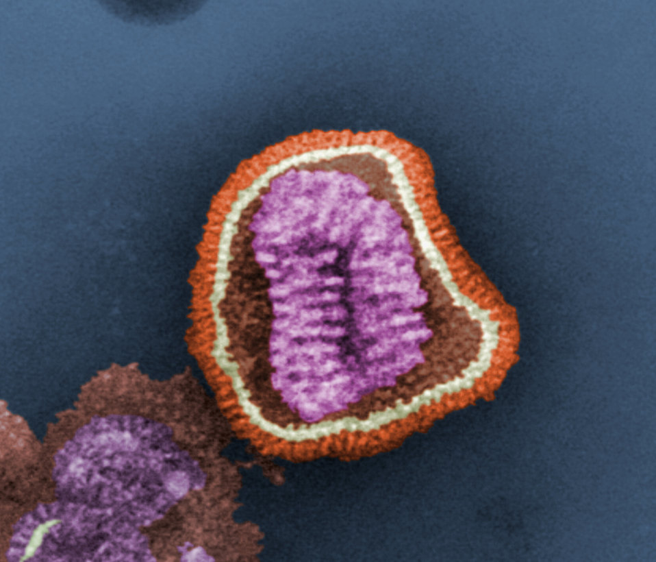 TEM image of an influenza virus